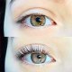 Comparison of two eyes, the one below has lifted lashes