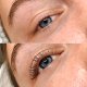 Comparison of two eyes, the one below has lifted lashese
